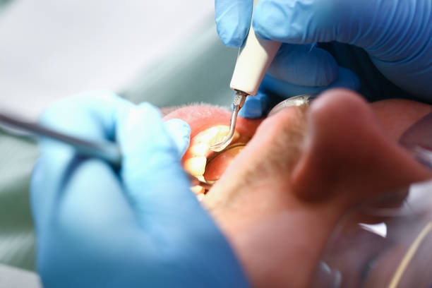 Best Emergency Dental Care for Broken or Chipped Teeth in Peosta, IA