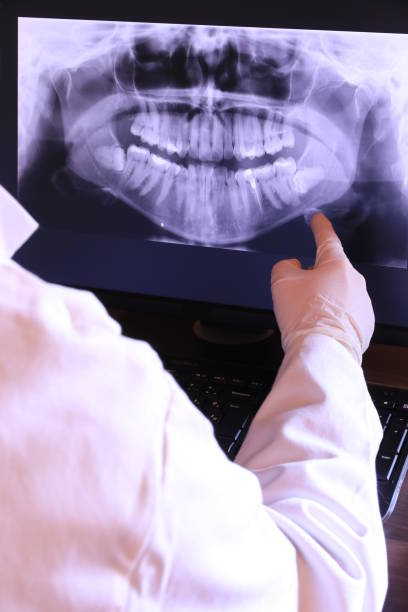 Best Emergency Tooth Extraction in Peosta, IA
